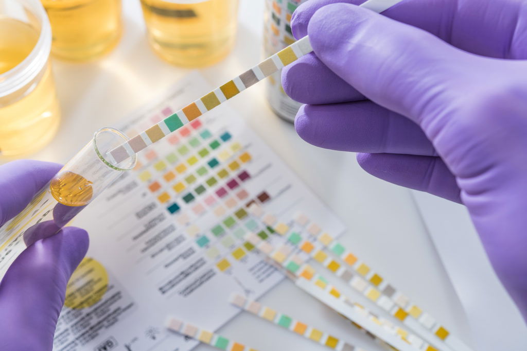 drug-test drug-test
